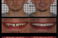 Anterior Aesthetics- Dr. Paul Peterson- Category Winner