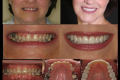 Full Mouth-Dr. Gordon Rye-