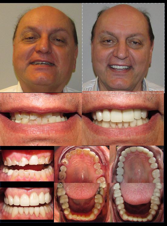 Dr. Brian Davidson Full mouth 2