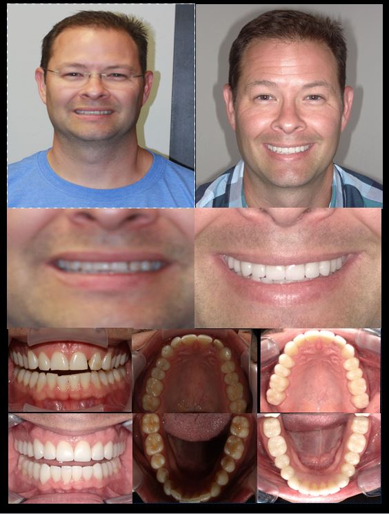 Dr. Pete Swan Full Mouth