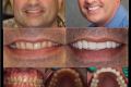 Dr. Brian Klaich full mouth