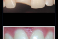 Single Tooth Match-Dr. Nicol Cook -Category Winner