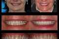 Category I - Anterior Aesthetics - Dr. Paul Peterson 2