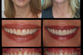 Category I - Anterior Aesthetics - Dr. Paul Peterson 3