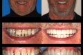 Category I - Anterior Aesthetics - Dr. Paul Peterson