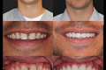 Category I Anterior Aesthetics - Dr. Robert Klaich